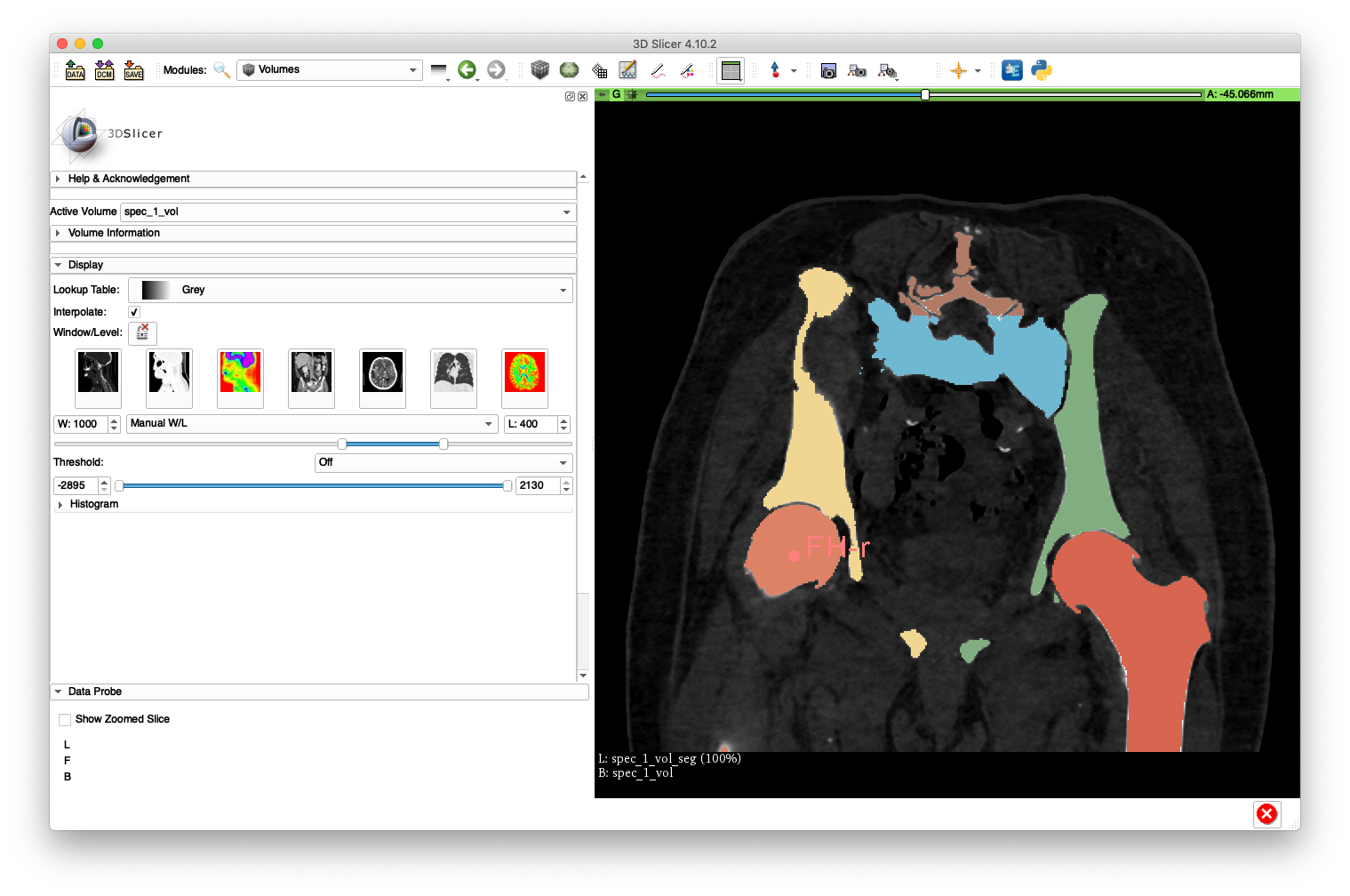 3D Slicer Preview 1